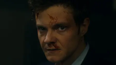 A cinematic close-up of Jack Quaid's bruised and bloody face as Nathan Caine, the man who cannot feel pain, in the action comedy movie NOVOCAINE.